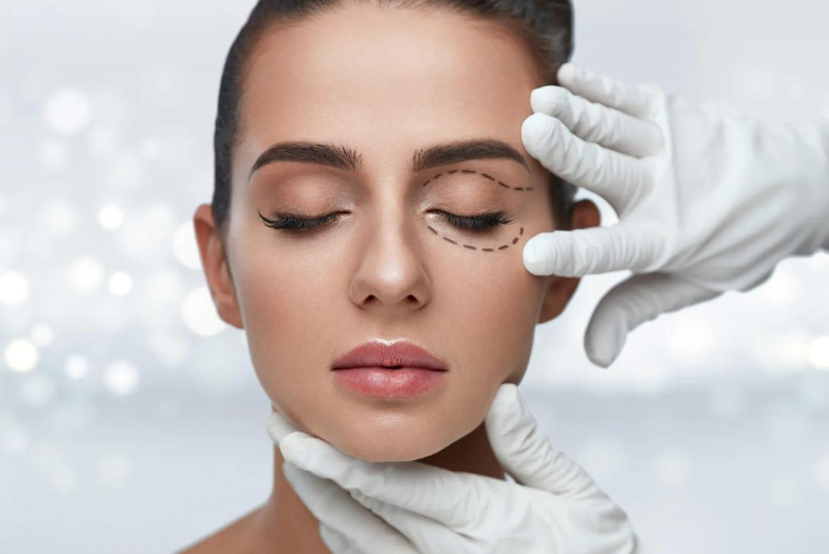 Chirurgie des paupières à Paris